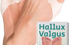 Miglior fascia per alluce valgo